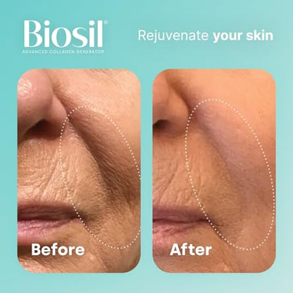 Biosil Collagen Generator - 120 Capsules - with Patented ch-OSA Complex - Generates & Protects Your Own Collagen