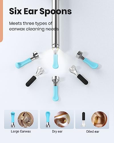 BEBIRD Ear Wax Removal Tool - R1 Upgraded Ear Cleaner with 1080P Camera, Smart