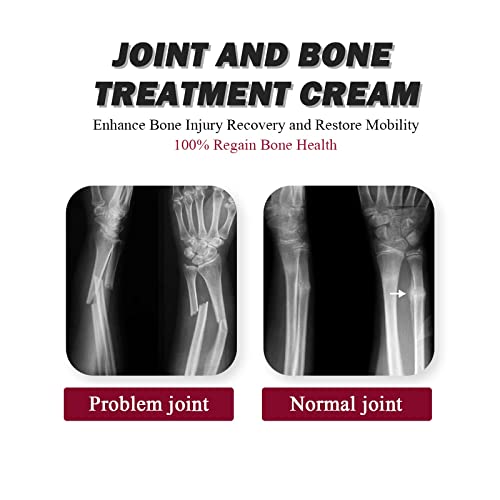 Joint Collagen Relieves Joint Soreness And Body Joint Care Collagen Get Thick Products