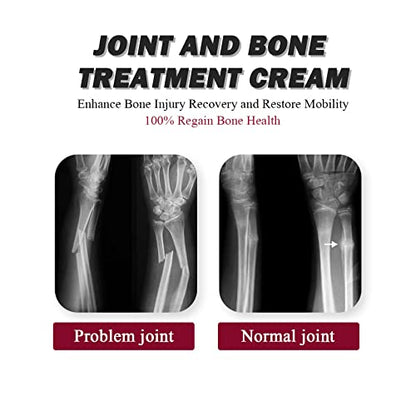 Joint Collagen Relieves Joint Soreness And Body Joint Care Collagen Get Thick Products