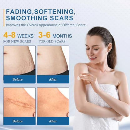 BORMSI Scar Cream,Active Silicone Dimethicone Scar Gel-Advanced