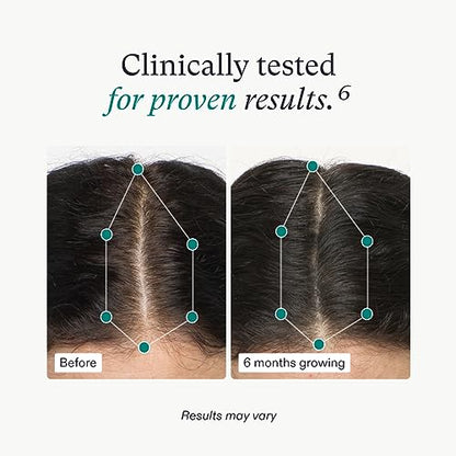 Nutrafol Women's Hair Growth Supplements, Ages 18-44, Clinically Proven for Visibly