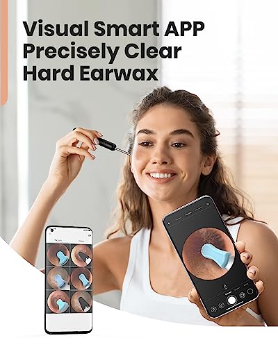 BEBIRD Ear Wax Removal Tool - R1 Upgraded Ear Cleaner with 1080P Camera, Smart