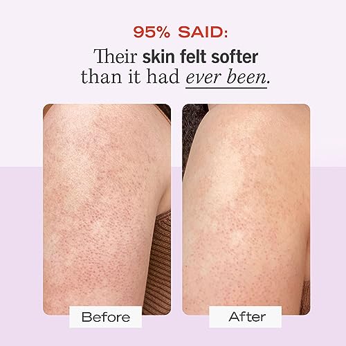 First Aid Beauty KP Bump Eraser Body Scrub – Exfoliant for Keratosis Pilaris with 10% AHA