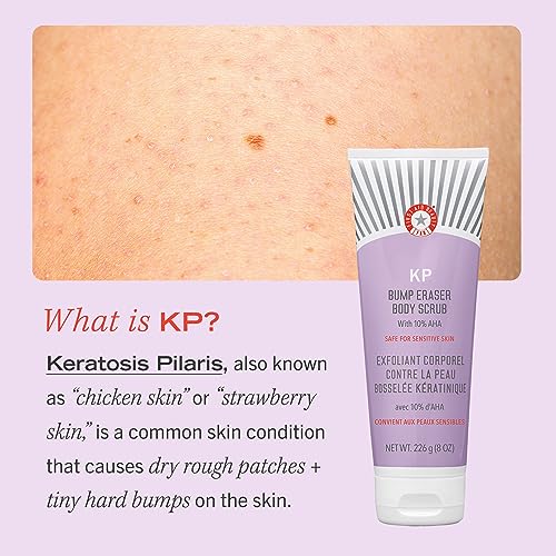 First Aid Beauty KP Bump Eraser Body Scrub – Exfoliant for Keratosis Pilaris with 10% AHA