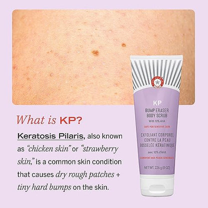 First Aid Beauty KP Bump Eraser Body Scrub Exfoliant for Keratosis Pilaris with 10% AHA