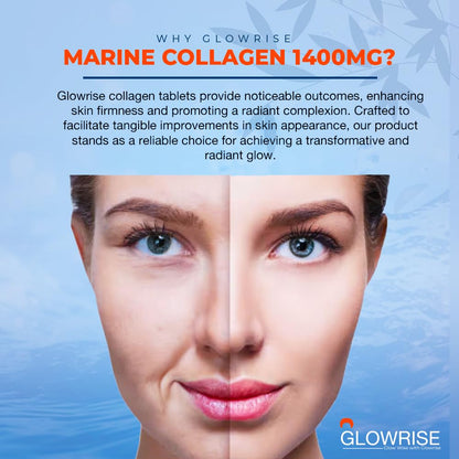 Pure Marine Collagen 120 Tablets 1400mg - Premium Blend with Hyaluronic Acid, Biotin, Vitamin C & E