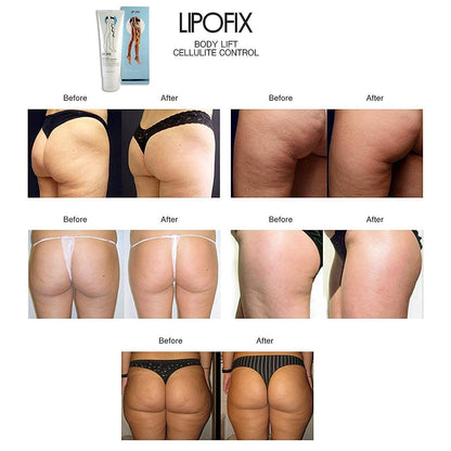 LIPOFIX Anti Cellulite Cream Luxurious Formula Body Contour Cream Effectively Tone