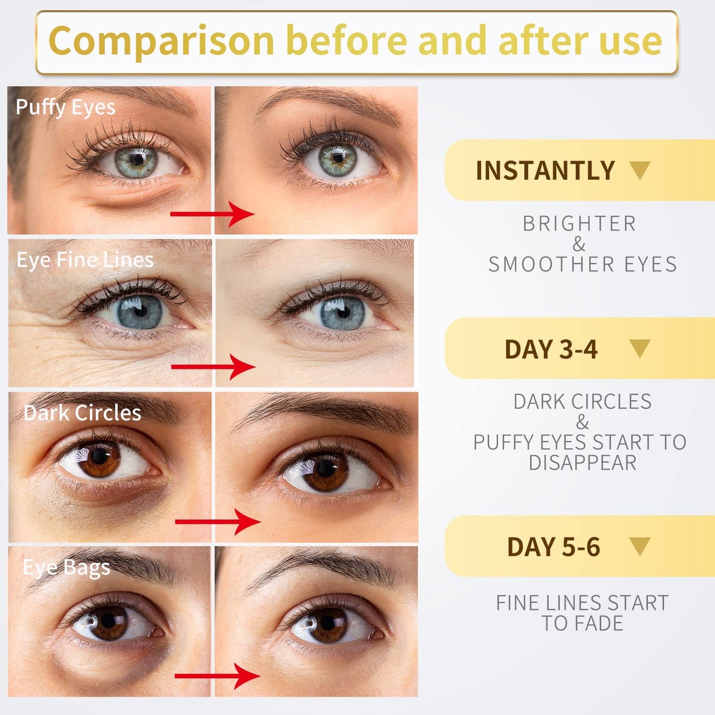 NAZANO Under Eye Patches - 60 Pcs - 24K Gold Eye Mask- Puffy Eyes & Dark Circles